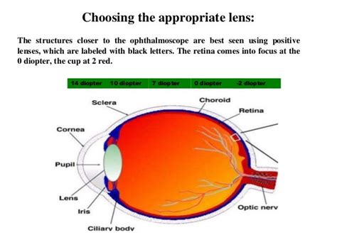 Ophthalmoscopy