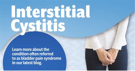 Interstitial Cystitis: Symptoms, Causes Treatment, 40% OFF