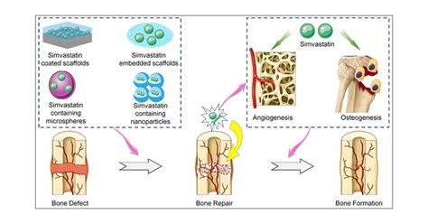 Simvastatin-Incorporated Drug Delivery Systems for Bone Regeneration | ACS Biomaterials Science ...