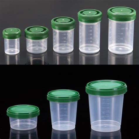 China FDA Registered Histology Specimen Containers - China Specimen Container, Histology ...