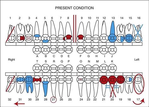 Dental Charting Symbols Dental Charting Symbols Australia with Dental Charting Symbols24166 ...