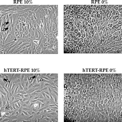 Morphology of RPE cells in culture. Midpassage parental (PD25) and... | Download Scientific Diagram