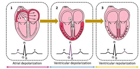 Successive Stages of Depolarization/repolarization of the Heart ...