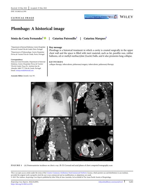 (PDF) Plombage: A historical image