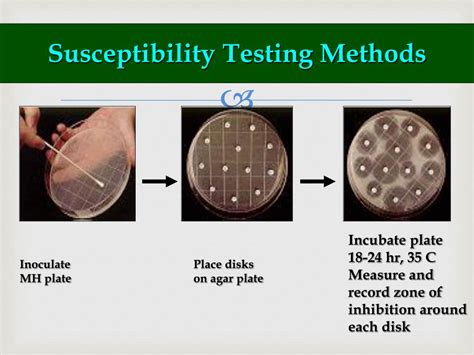 PPT - ANTIBIOTIC SENSITIVITY TESTING SKILL BASED LEARNING PowerPoint Presentation - ID:2096125