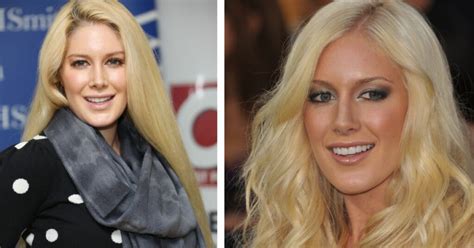 Heidi Montag Before and After Surgery: The Truth Behind Her Beautiful Looks