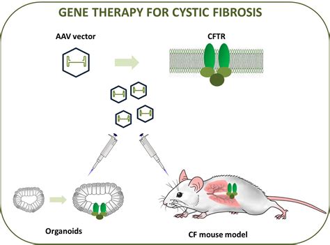 Gene therapy: a promising candidate for cystic fibrosis treatment ...