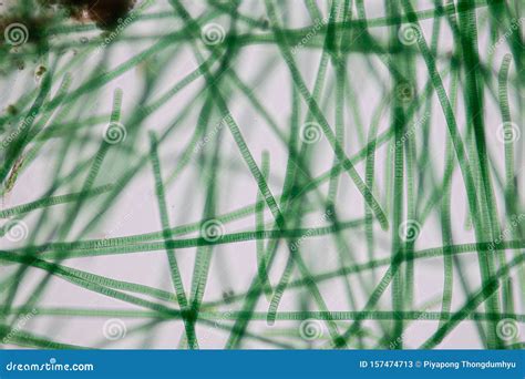 Oscillatoria is a Genus of Filamentous Cyanobacterium, Oscillation in Its Movement Under the ...