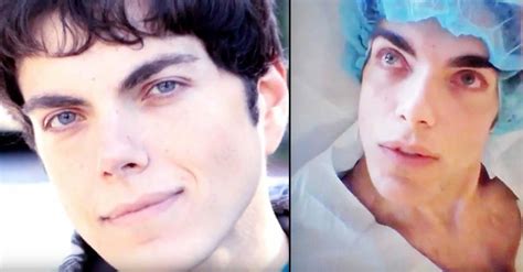 Man Doesn't Listen To Dangers Of Eye-Color Surgery And Ends Up Going Blind | iHeart