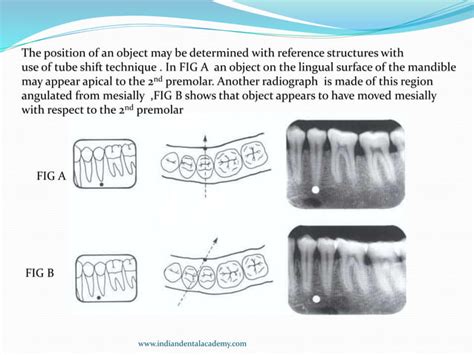 PROJECTION GEOMETRY/ dental implant courses