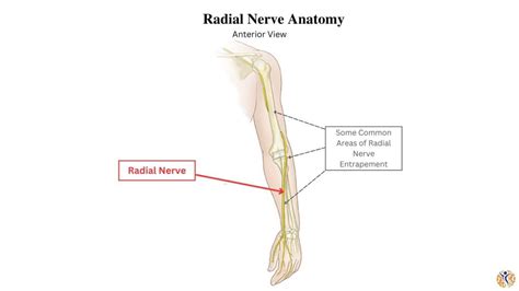 Radial Nerve Entrapment - Ilyas Munshi, M.D.