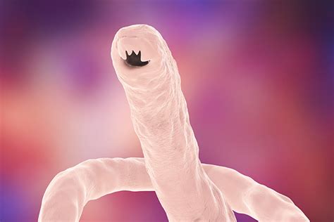 Hookworm infection – causes, side effects and treatments at NaturalPedia.com