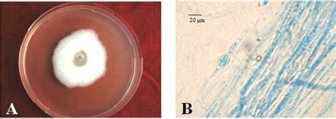 A, Fungal colony of the Fusarium solani growing on PDA; B, Microscopic... | Download Scientific ...