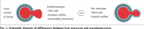 Figure 1 from Interventional Radiology in the Management of Visceral Artery Pseudoaneurysms: A ...