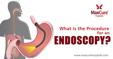 Medicover Hospitals: ugi endoscopy test