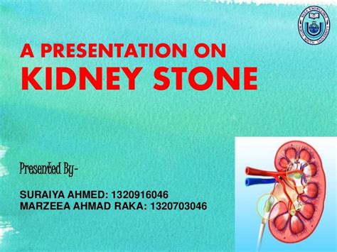 Presentation kidney-stone final