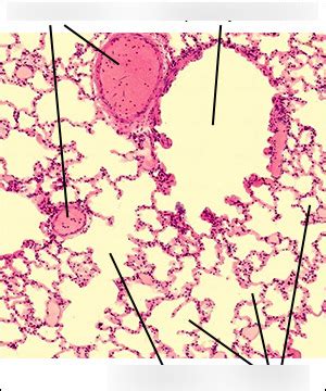 Bronchiole and alveoli under microscope Diagram | Quizlet