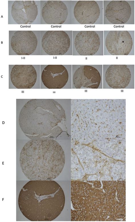 Intrinsic hepatocyte dedifferentiation is accompanied by upregulation of mesenchymal markers ...