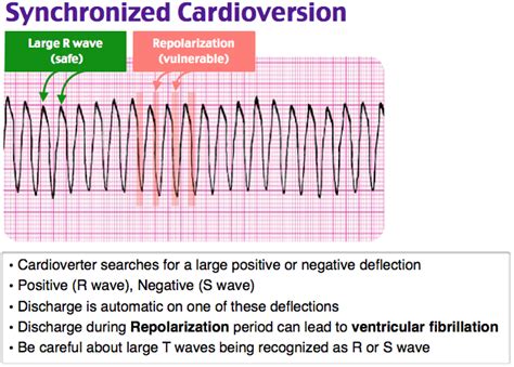 Rosh Review | Emergency medicine, Cardiac nursing, Ekg interpretation