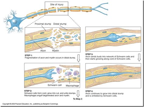 Degeneration & regeneration of peripheral nerves - Medatrio