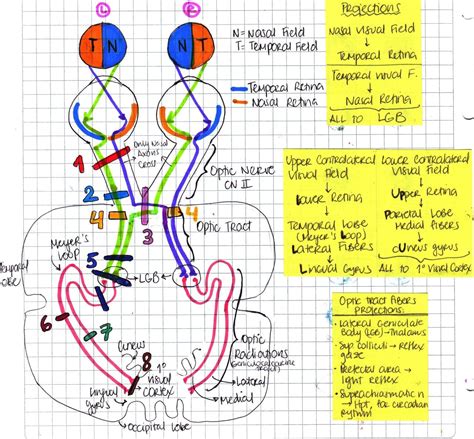 My Notes for USMLE — VISUAL PATHWAY & VISUAL FIELD LESIONS | Medicine notes, Medical school ...