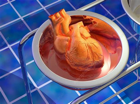 Heart surgery, artwork - Stock Image - M172/0675 - Science Photo Library