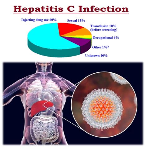 Etiology of hepatitis c