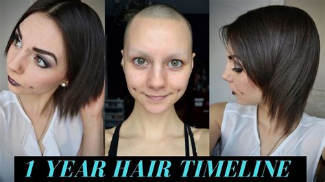 1 Year Hair Growth Timeline (Bald & No Eyebrows) - YouTube | 1 year hair growth, Head hair ...