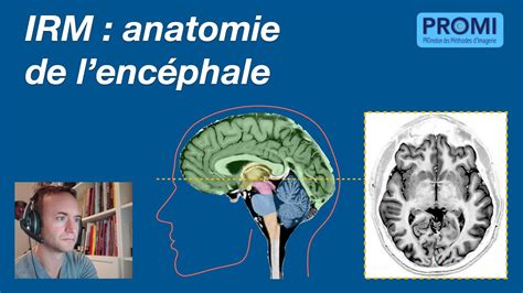 IRM : anatomie de l'encéphale - YouTube