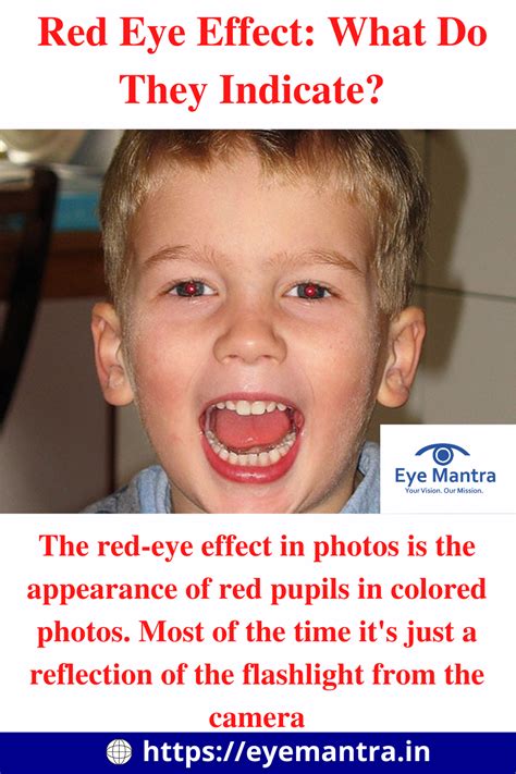 Discover the Mystery Behind the Red Eye Effect