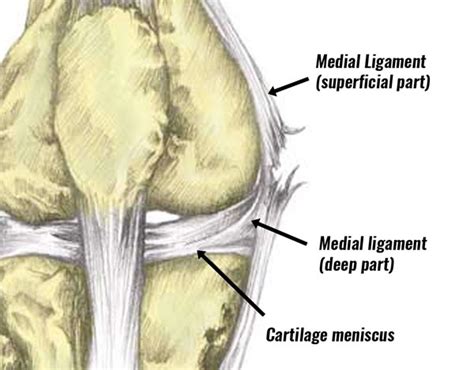 MCL Sprain - Symptoms, Treatment, Exercises & Rehabilitation (2022)