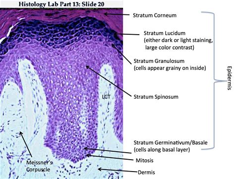 Thick Skin - Labeled - Histology | Thick skin, Medical careers, Epidermis