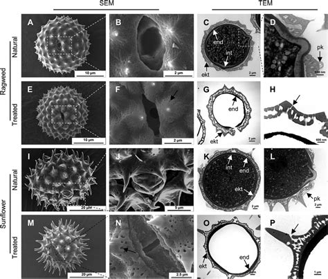 Scanning electron microscope (SEM) and transmission electron microscope... | Download Scientific ...