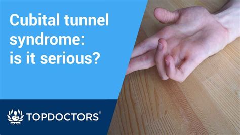 Cubital tunnel syndrome: is it serious? - YouTube