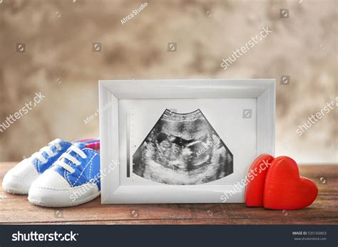 Ultrasound Picture Baby Photo Frame Children Stock Photo 535169803 ...