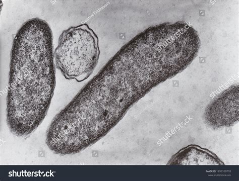 "View microscope of bacteria" - 4.854 Ảnh, vector và hình chụp có sẵn ...