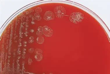 Pseudomonas Putida On Agar