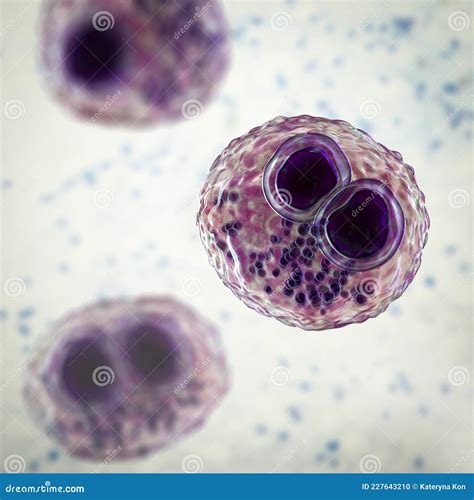 Cytomegalovirus CMV in Human Cell, Owl's Eye Inclusion in Nucleus Stock Illustration ...