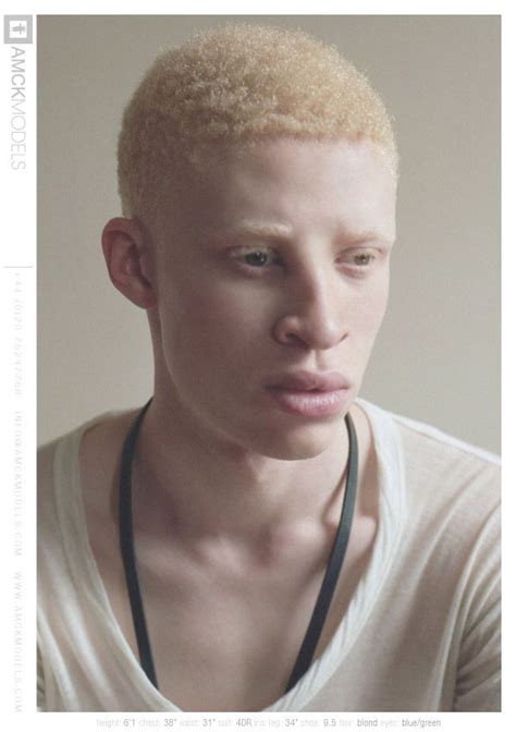 Image from http://i.models.com/oftheminute/images/2011/09/33993/05_Shaun_Ross_.jpg. | Albino ...