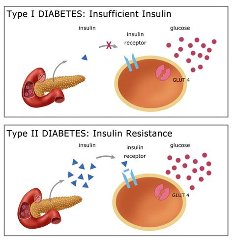 Natural Herbal Remedies for Diabetes Mellitus