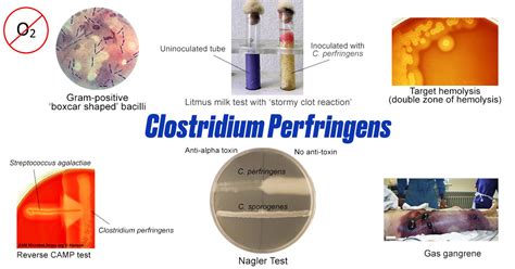 Clostridium perfringens: Properties, Diseases, Diagnosis • Microbe Online