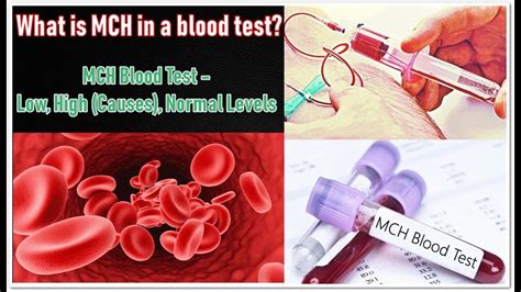 MCH Blood Test – Low, High (Causes), Normal Levels - YouTube