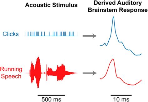 Auditory Brainstem Responses to Continuous Natural Speech in Human Listeners | eNeuro