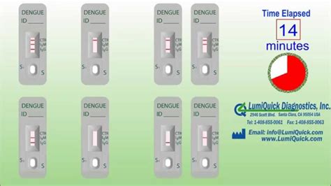 Dengue Antibody IgG / IgM Test - YouTube