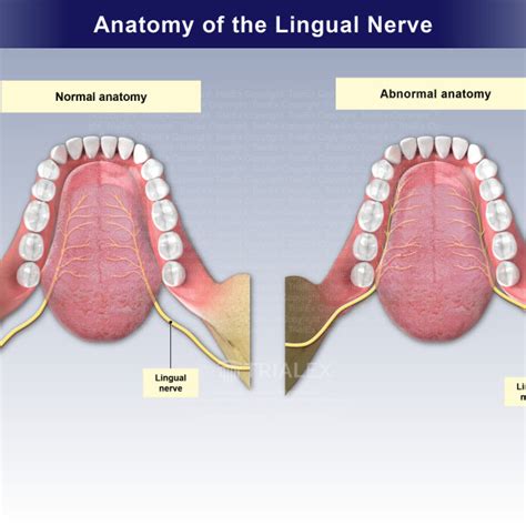 Medical Legal Exhibits - Legal Animations & Trial Graphics - Tria...