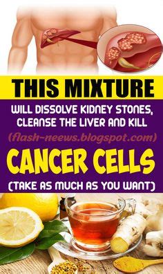 THIS MIXTURE WILL DISSOLVE KIDNEY STONES, CLEANSE THE LIVER AND KILL CANCER CELLS (TAKE AS MUCH ...