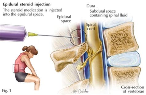 Guardian Headache and Pain Management Institute - Bloomington-Normal - LocalWiki