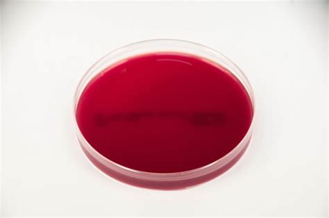 Tryptic Soy Blood Agar - TSBA - Anaerobe Systems