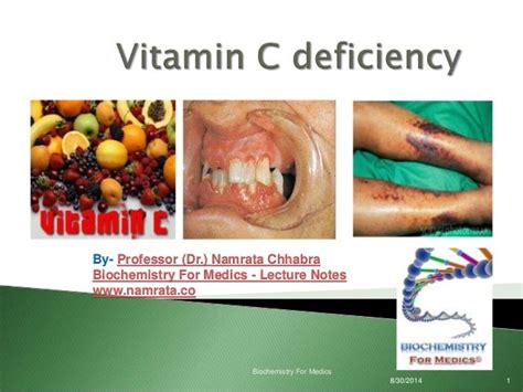 Vitamin C deficiency