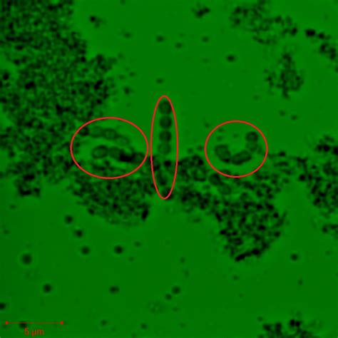 File:Streptococcus thermophilus 5 microns.jpg